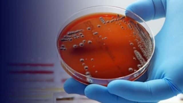 Imagem do curso Microbiologia: Fundamentos