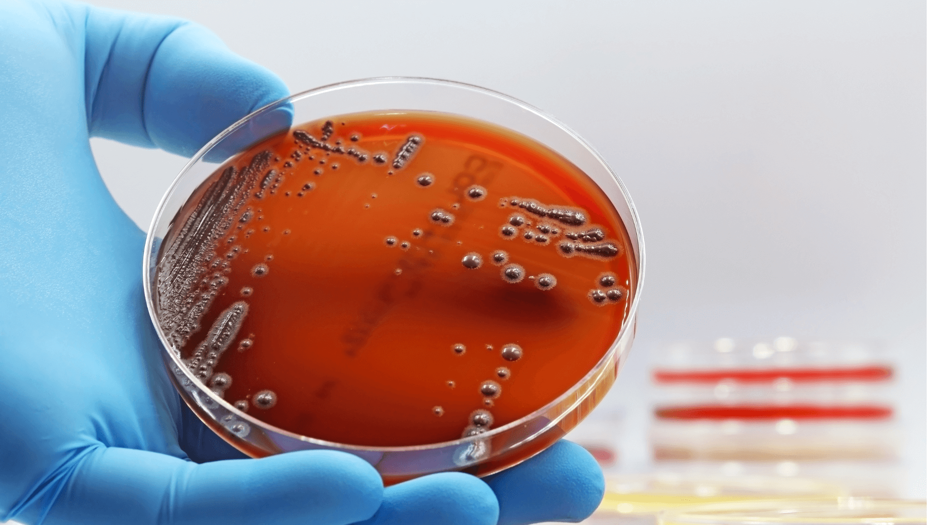 Imagem do curso Microbiologia I
