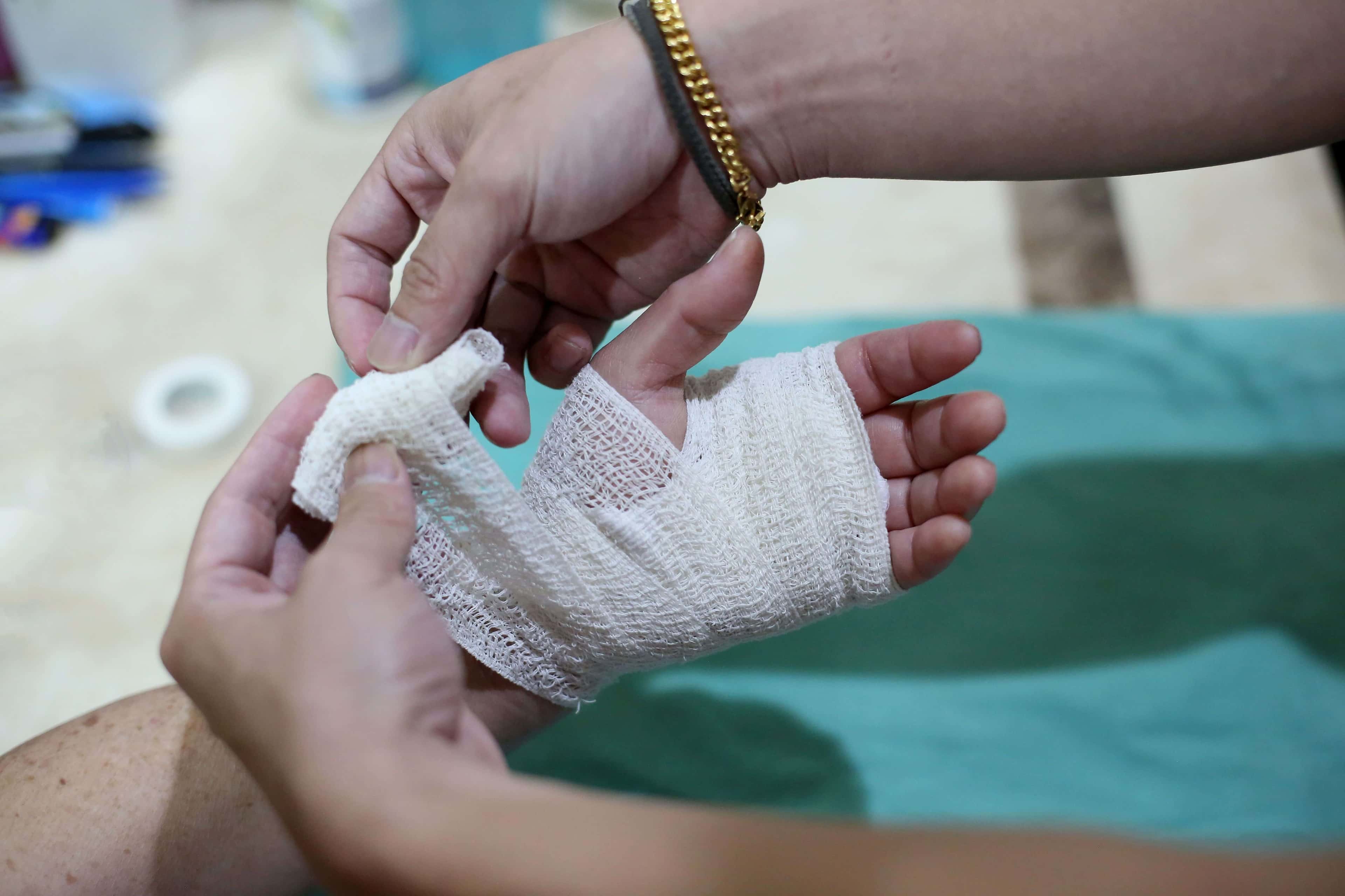 Imagem do curso Abordagem e Tratamento de Úlceras, Ostomias e Feridas