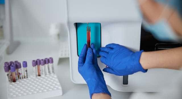 Imagem do curso Avaliação Bioquímica e Hematológica nos Desequilíbrios Multissistêmicos