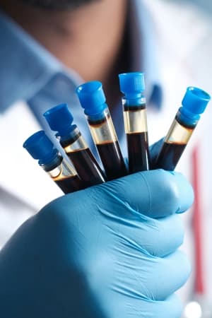 Compreender fundamentos de hematologia e hemoterapia