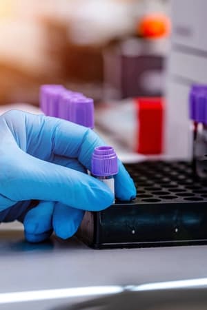 Prevenir reconhecer e manejar reações transfusionais