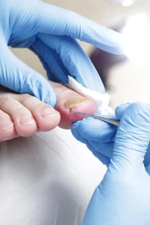 Compreender anatomia, biomecânica e fisiologia dos pés