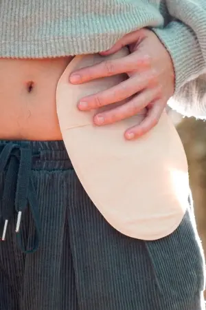 Capacitar profissionais em técnicas de Estomaterapia