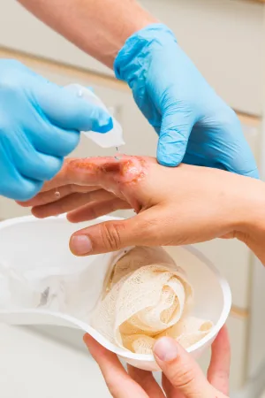 Desenvolver precisão em técnicas de limpeza avançada.