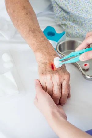 Capacitar profissionais no manejo avançado de feridas.