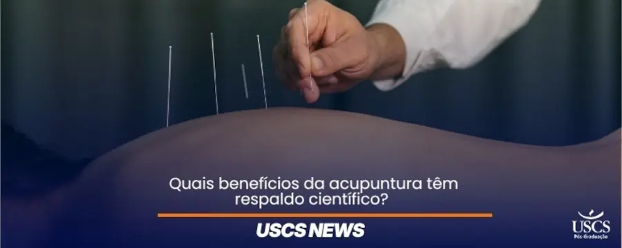 Benefícios da acupuntura: o que a ciência indica
