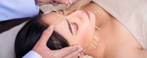 O que é Acupuntura? Descubra como essa área pode transformar sua carreira na saúde
