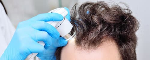 Tricologia ou Terapia Capilar: Entendendo as Diferenças e Orientando os Pacientes