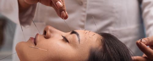 Acupuntura: Alívio Efetivo para Dores Crônicas