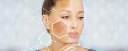 Principais tratamentos para hiperpigmentação e melasma que um profissional de estética pode realizar