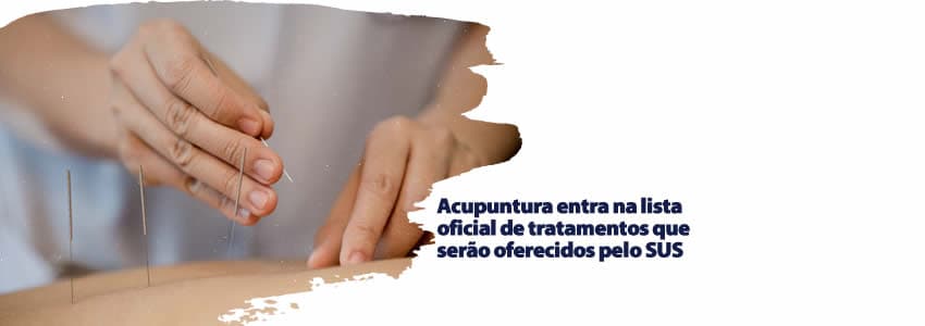 Acupuntura entra na lista oficial de tratamentos que serão oferecidos pelo SUS