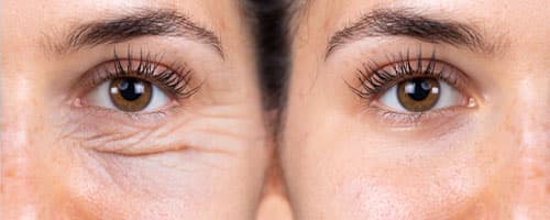 Biomedicina estética: como funciona a área?