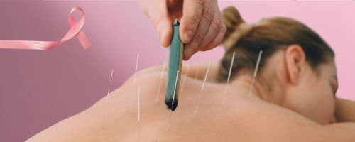 Outubro Rosa: Acupuntura pode diminuir efeitos colaterais de terapia para câncer de mama
