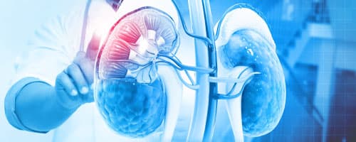 Enfermagem Nefrológica: Avanços Para Enfermeiros no Cuidado aos Pacientes Renais