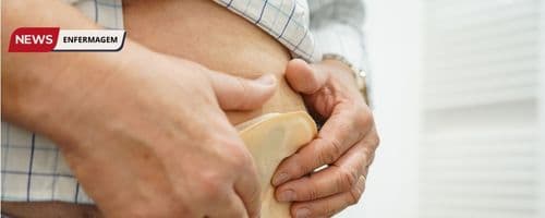 O Cuidado Essencial: O Papel da Enfermagem em Estomaterapia no Suporte aos Pacientes com Estomias