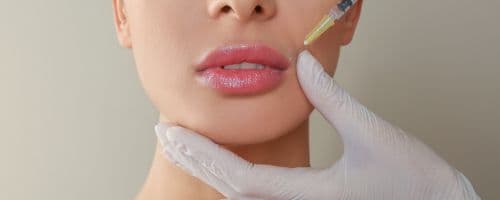 A principal diferença entre o PMMA e o ácido hialurônico no preenchimento labial