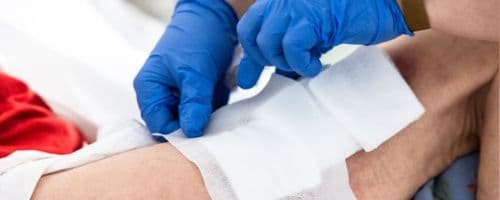 Tratamento de Feridas Crônicas: Qual o papel da estomaterapia?