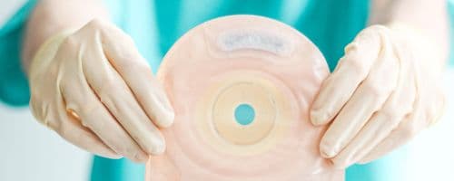 Como é o mercado de Enfermagem em Estomaterapia e qual a remuneração da área?