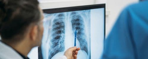 A Pós USCS está com curso novo na área de fisioterapia: Reabilitação Cardiorrespiratória Funcional