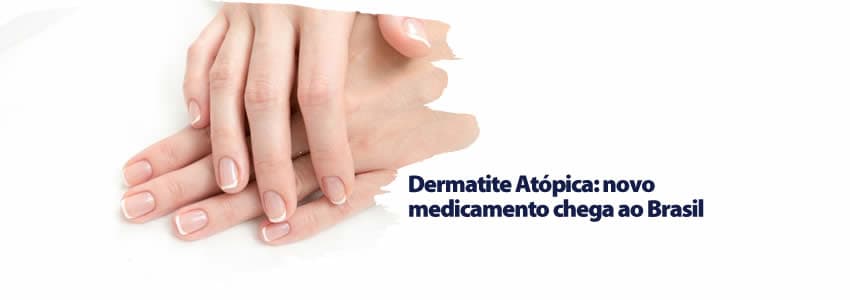 Dermatite Atópica: novo medicamento chega ao Brasil