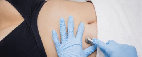 6 Técnicas para Tratar Gordura Localizada