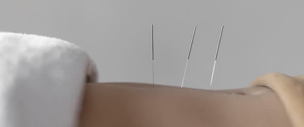Acupuntura após um quadro de Covid-19