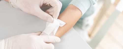 Avaliação e Cuidados de Feridas Cirúrgicas: Como Enfermeiros podem Garantir uma Recuperação Segura