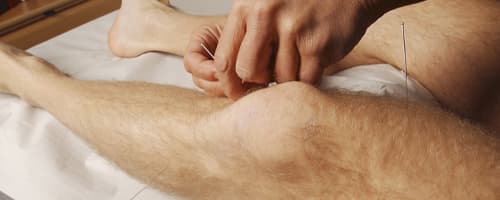 Acupuntura e futebol: técnica que ameniza dores e ajuda na recuperação de lesões articulares