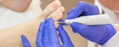 Como funciona a área de Enfermagem em Podiatria Estética?