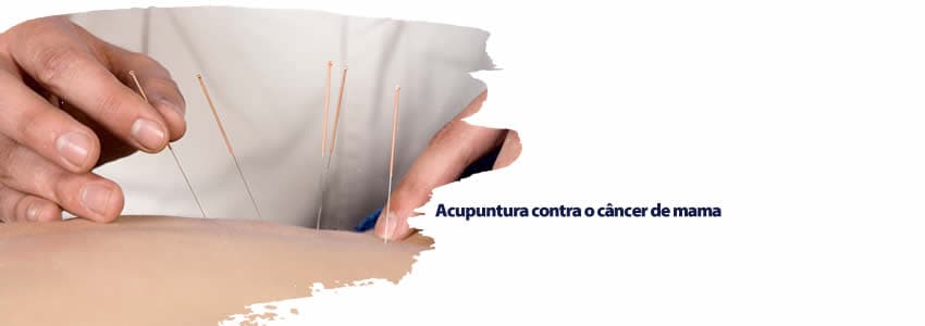 Acupuntura contra o câncer de mama 