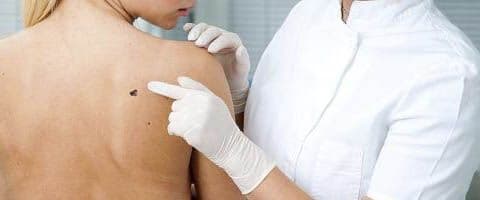 Proteja-se contra o câncer de pele