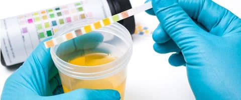 O que a cor da sua urina diz 