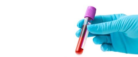 Segundo estudo, exame de sangue pode personalizar tratamento de depressão