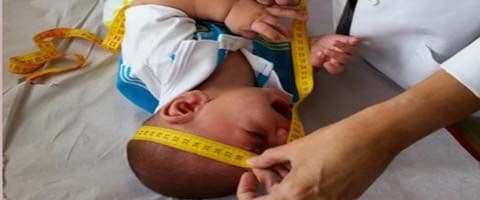 Saúde e Zika Virús – Estudos podem fazer o país mudar protocolo sobre microcefalia