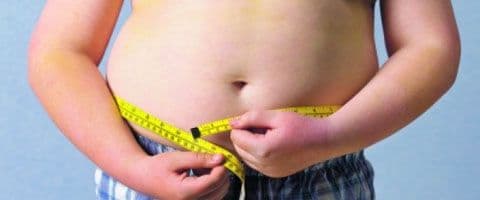 Obesidade pode elevar riscos de problemas na gengiva