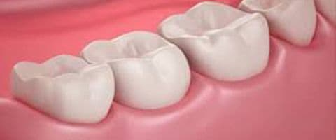 Obesidade pode elevar riscos de problemas na gengiva