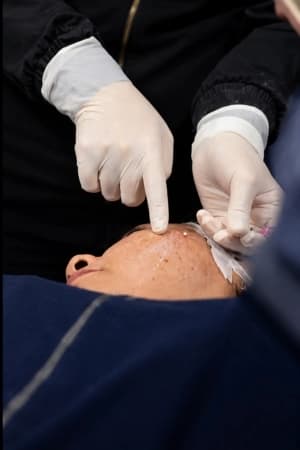 Dominar técnicas injetáveis em estética facial
