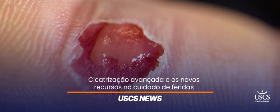 Cicatrização avançada: o que o todo enfermeiro precisa saber