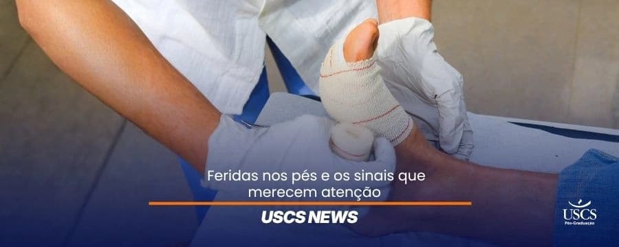 Feridas nos pés: quais sinais exigem avaliação?