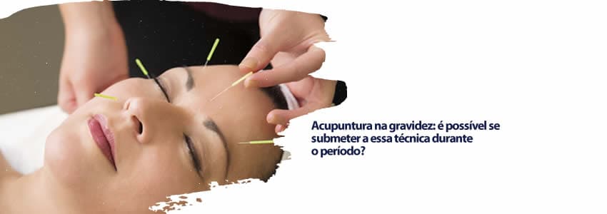 Acupuntura na gravidez: é possível se submeter a essa técnica durante o período?