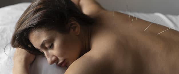 A acupuntura é recomendada para os atletas que correm