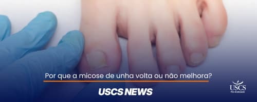 Onicomicose: causas, resistência e tratamento clínico