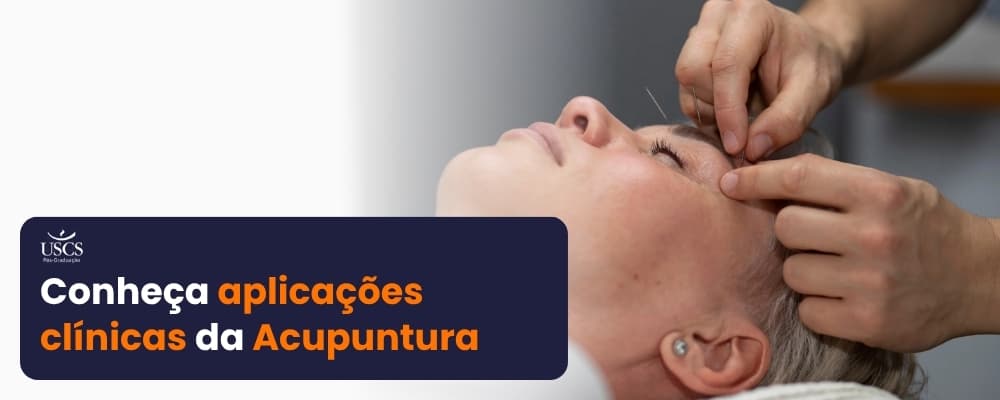 O que a Acupuntura trata? Conheça os benefícios comprovados