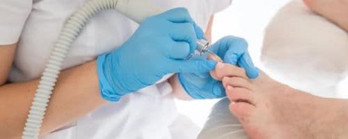 Cuidados Podiátricos em pacientes com Diabetes