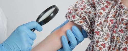 A importância e as funções do Enfermeiro Dermatológico