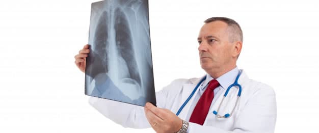 O que é embolia pulmonar?