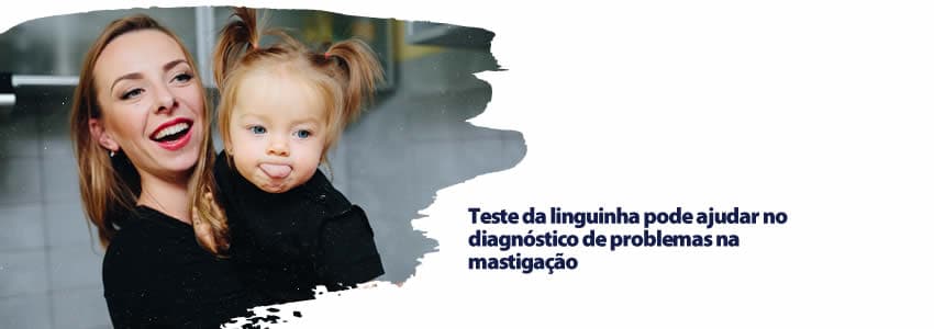 Teste da linguinha pode ajudar no diagnóstico de problemas na mastigação