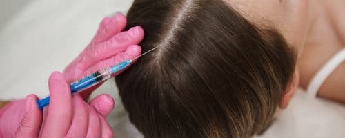 Queda de cabelo pós dengue: Como o tricologista pode ajudar no tratamento