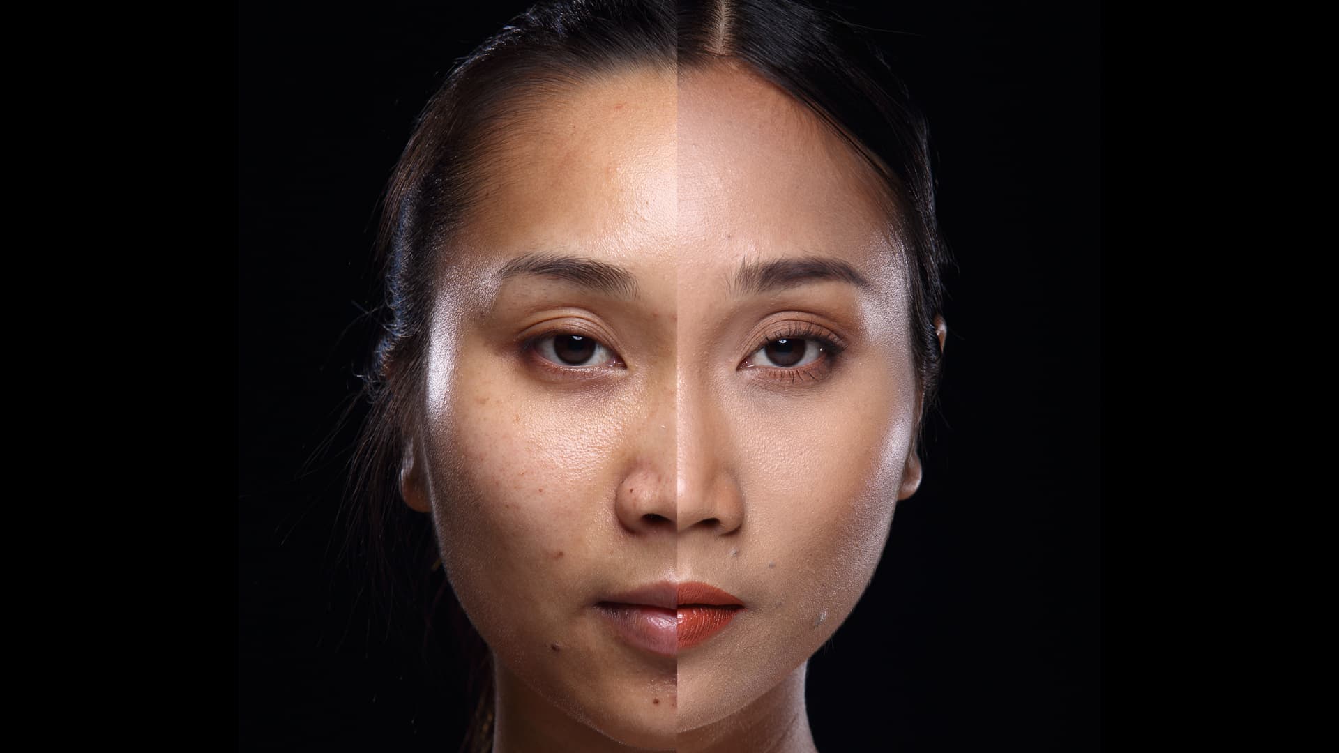 Cinco benefícios da fotoproteção contra o melasma